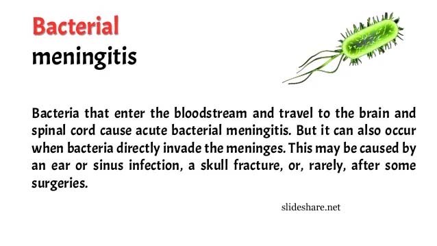 Bacterial Meningitis